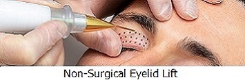 Fibroblast Eyelid Lift