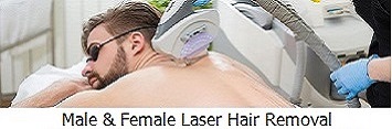 Male and Female Laser Hair Removal